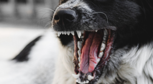 Dogs do not tie a leash, why are the injured always children?
